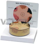 Skin Cancer Model